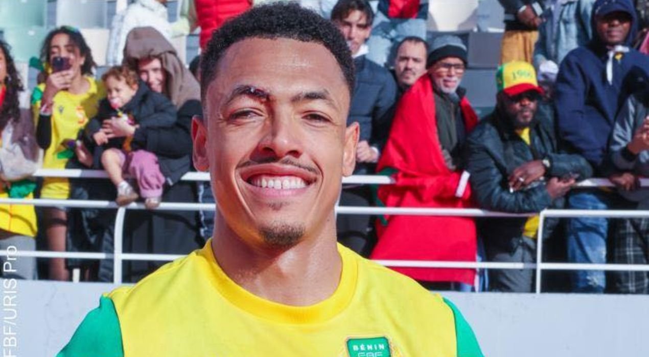 Première victoire du Bénin à la CAN 2025 : « Une immense fierté » pour Yohan Roche